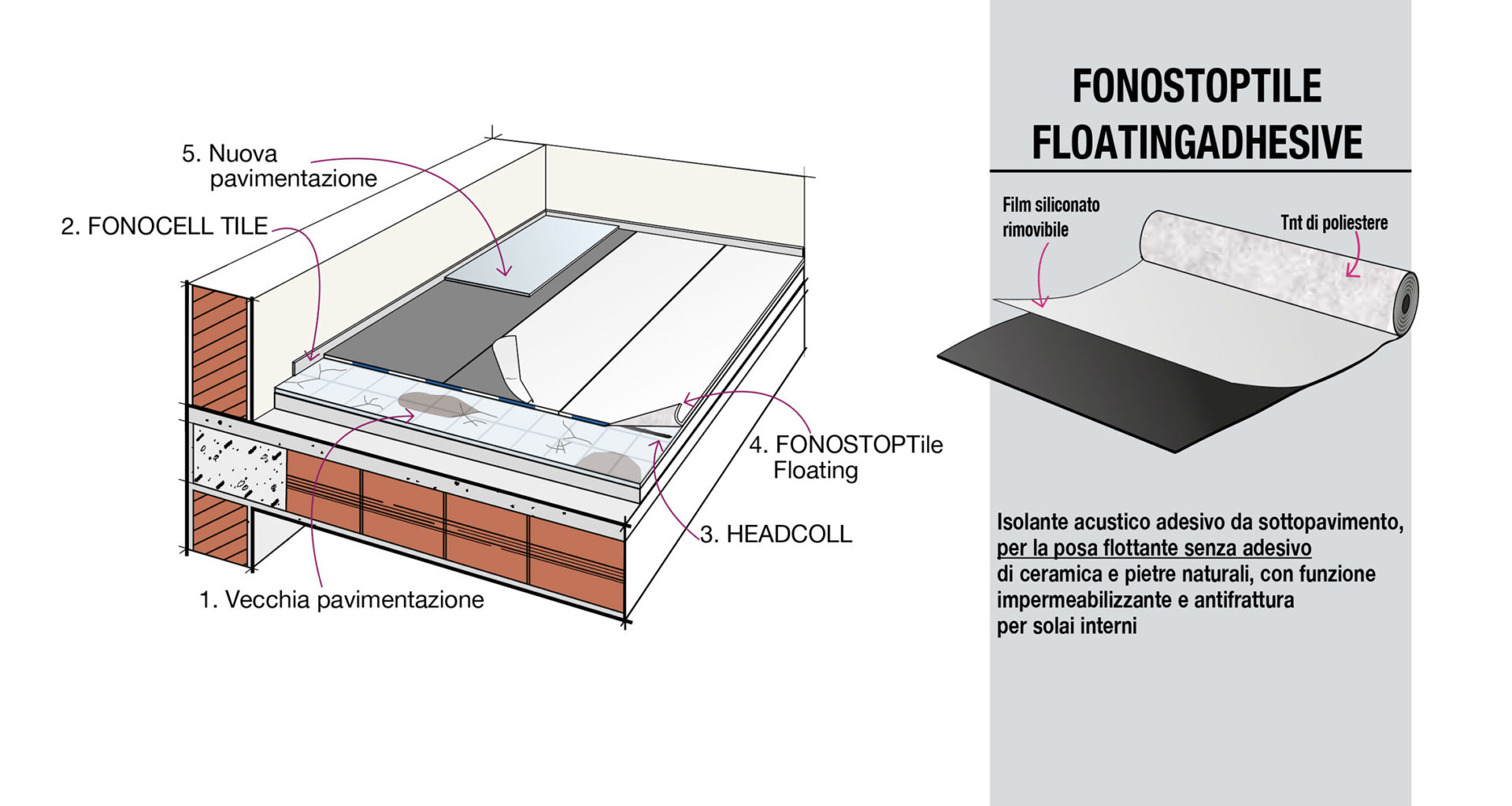 fonostotile-floating-aadhesive